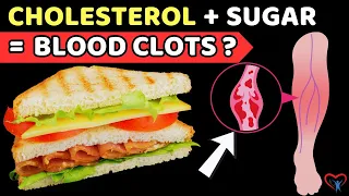 These 5 Dangerous Combinations Of Cholesterol And Sugar In Foods Will Lead You To Have Blood Clots