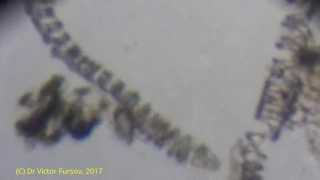 Жизнь под Микроскопом: Водоросли Спирулина и Инфузории Туфельки из Аквариума