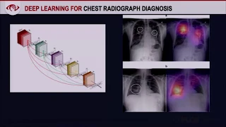 Artificial Intelligence Applications in Medical Imaging-- Bhavik Patel, MD (SABI 42nd Annual Course)