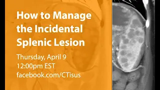 Facebook Live: How to Manage the Incidental Splenic Lesion