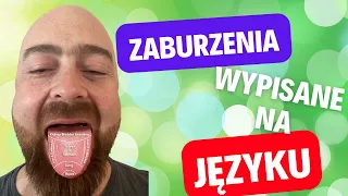 Zdiagnozuj się sam - diagnostyka z języka