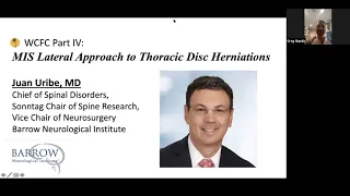 MIS Lateral Approach for Thoracic Disc Herniation with Juan Uribe, MD, FAANS