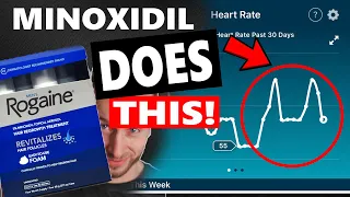 Nobody is talking about Minoxidil doing THIS to your heart!