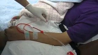 how to connect the patient to haemodialysis machine ?