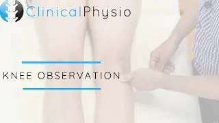 Observation of the Knee Joint | Clinical Physio
