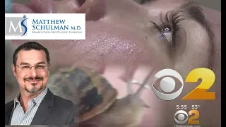 Dr Matthew Schulman Fancy Facials -  CBS 2 News New York - Schulman Plastic Surgery