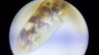 Ostracode (?) 100x : Carson microflip