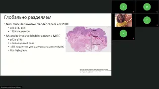 Подготовка к экзамену ESMO: стандарты лечения урологических опухолей