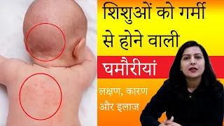 शिशुओं को घमौरी होने के कारण, लक्षण व घरेलू उपचार | Heat rash or prickly heat in Hindi |My Baby Care