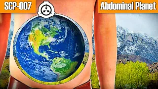 SCP-007 Abdominal Planet | object class euclid