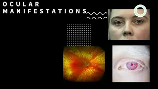 Systemic Diseases with Ocular Manifestations- Part 1