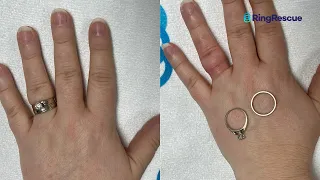 (LIVE VIDEO) WEIGHT GAIN Stuck Ring Removal Using The Ring Rescue Compression Device