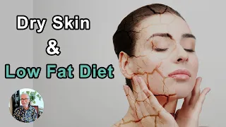 Do People Develop Dry Skin On A Low-Fat Diet? -  John McDougall, MD