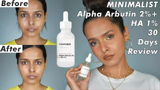I Tried MINIMALIST's Alpha Arbutin 2% + HA 1% Serum for 30 Days & here's the review