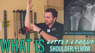 What is Little League Elbow/Shoulder? | MAJOR Injury!
