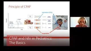 CPAP and NIV in Pediatrics: The Basics