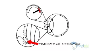 Ophthalmology – Chronic Visual Loss: By Sherif El-Defrawy M.D.