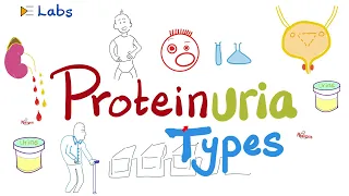 Proteins in the Urine (Proteinuria) - Causes and Types - Nephrology Series