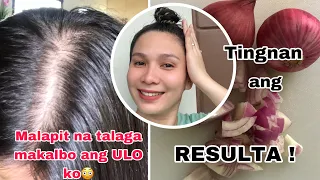 ONION JUICE | SIBUYAS para sa HAIR LOSS, THICK and SHINY HAIR ? 😳