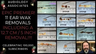 1 HR/11 EAR WAX REMOVALS