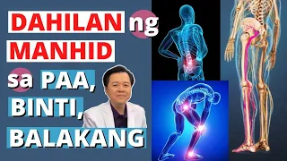 Dahilan ng Manhid sa Paa, Binti, Balakang - Payo ni Doc Willie Ong