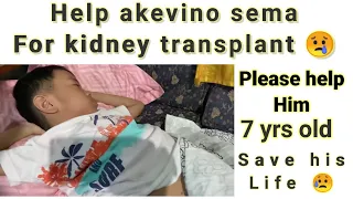 Please help  akivinu sema life  for Kidney transplant. @NagaMotovlogger