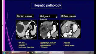 تشريح البطن فى الاشعه المقطعية CT Anatomy abd pelvis