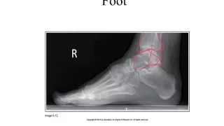 lower extremity