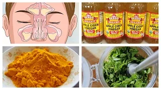 Best Natural Home Remedies for Sinusitis