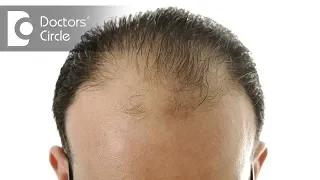 What is the role of balding genes, hormones & age in male pattern baldness? - Dr. K Prapanna Arya