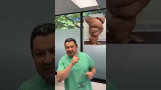 Lipedema Disease: Diets Don't Work - Lipedema Awareness - Dr. Boris Volshteyn