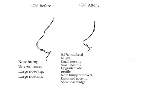 “ ᵛⁱʳᵗᵘᵃˡ ⁿᵒˢᵉ ˢᵘʳᵍᵉʳʸ “ ; Nose reconstruction subliminal ♡¸.•* Ultra Effective 🍥