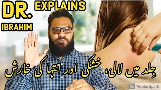 Skin Mein Lali, Kushki | Kharish Ka Ilaj | Treat Itchy & Red Skin | Dr. Ibrahim