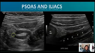 Optimizing The Appendix