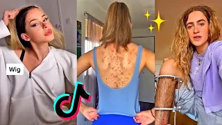 Embracing Body Insecurities (Body Positivity) *Part 3* | TikTok Compilation