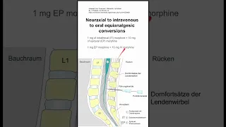Neuraxial to intravenous to oral equianalgesic conversions