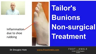 Tailors Bunion Best Practices | Seattle Podiatrist