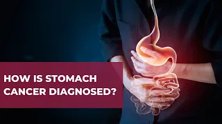 How Is Stomach Cancer Diagnosed? | Ask A Gut Doctor