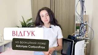 Відгук на фракційний лазер Adonyss CarbonFrax CO2