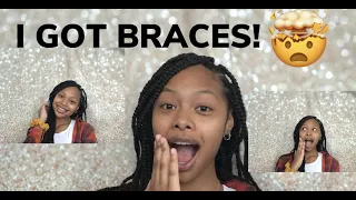 I GOT BRACES!