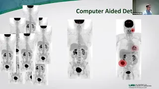 AI in Nuclear Medicine