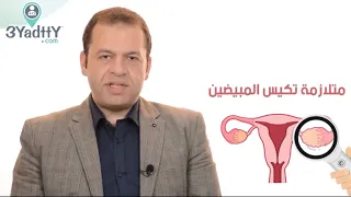 Polycystic ovarian syndrome PCO dr M Ramadan
