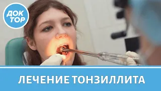 Как вылечить хронический тонзиллит