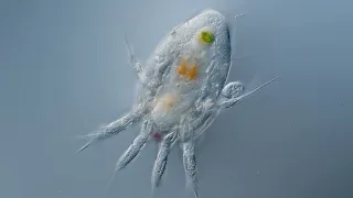 Nauplius with a Peritrich epibiont