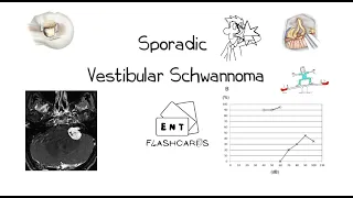 Sporadic Vestibular Schwannoma - an Overview & Key Viva Questions