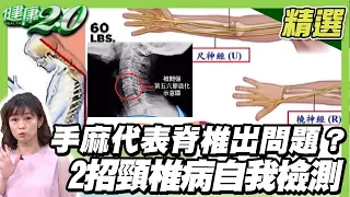 手麻代表脊椎出問題？2招頸椎病自我檢測 用大拇指+三指放鬆頸部肌群 【健康2.0精選】