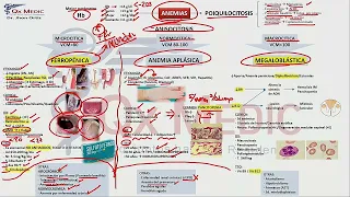 Mapas mentales - Anemia 1