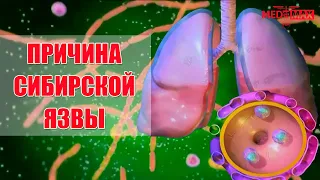 Сибирская язва. Причина возникновения?