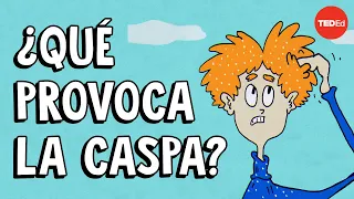 ¿Qué provoca la caspa, y cómo puedes eliminarla? - Thomas L. Dawson