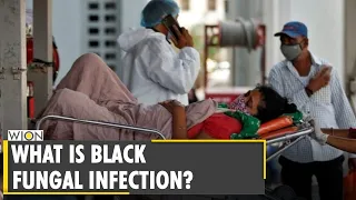 Black Fungus infections on the rise in India | Anti-Fungal drug | Mucormycosis | Latest English News